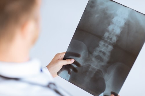 Legal Options for Family Members in Georgia Fatal Spinal Injury Accidents