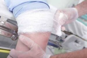 How to Choose the Right Attorney for Your Nuclear Plant Injury Case in South Carolina